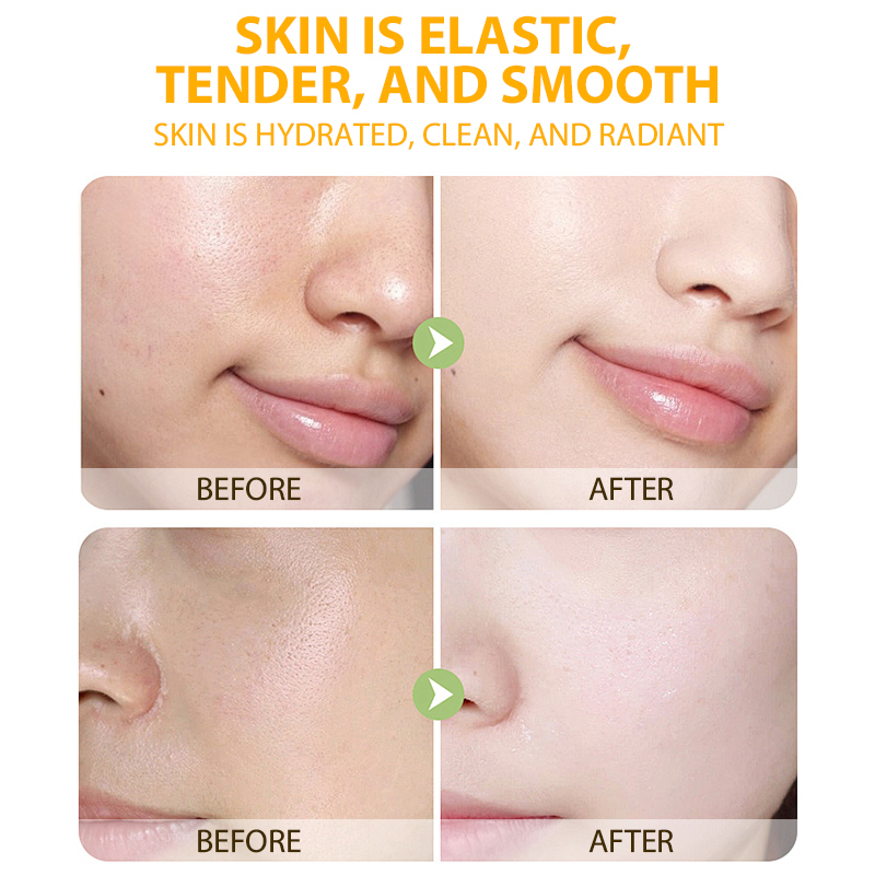 BUY 1 TAKE 1 YESHUI 500ml Vitamin C Whitening Toner – For Dark Spots, Acne Scars & Glowing Skin